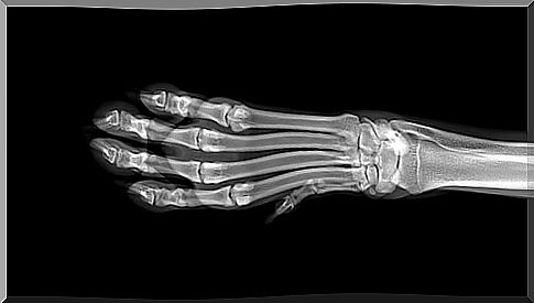 X-ray of a dog's paw