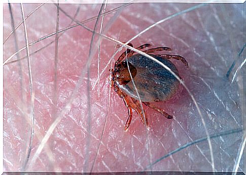 Rickettsia rickettsii: tick